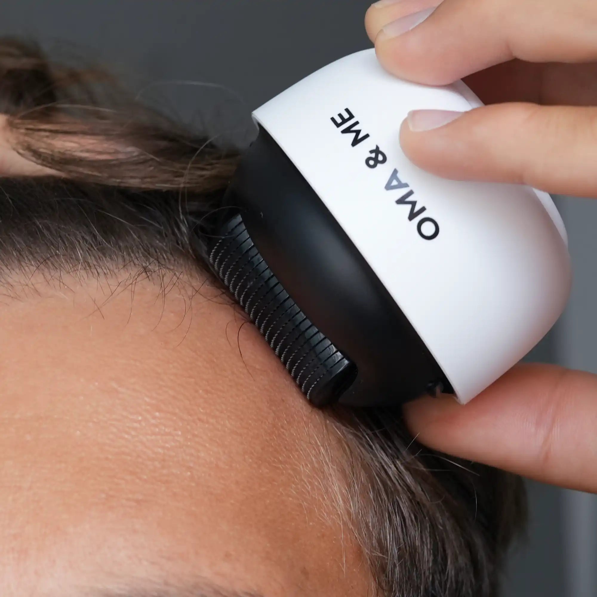 Scalp Derma Roller